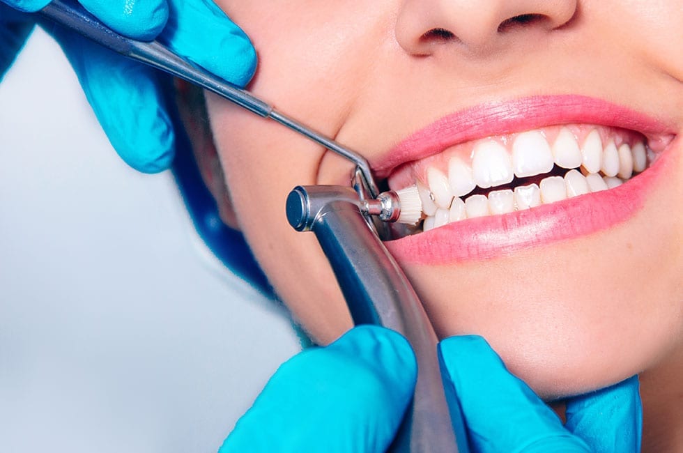 dental cleaning in mission tx