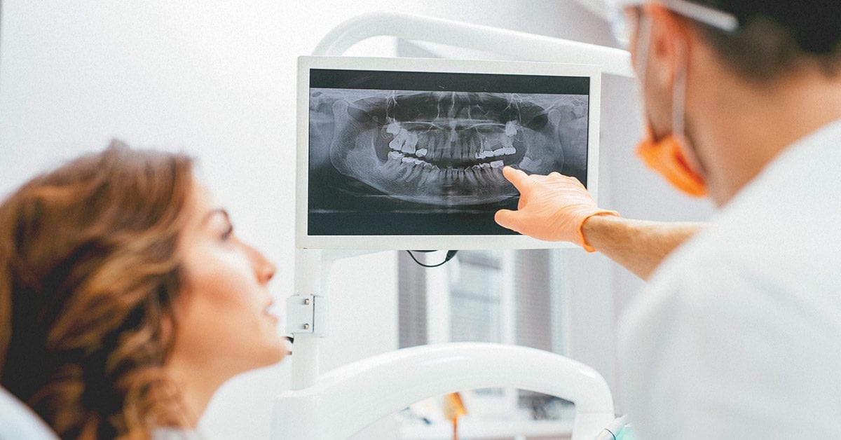 dental x-rays